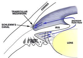 Glaucoma