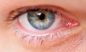 Glaucoma Services